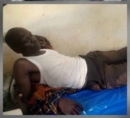 Amolatar Robbery Suspect Escapes After Motorcycle Crash, Two Sustain Broken Legs